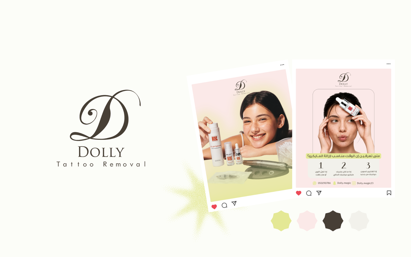 مشروع Dolly Tattoo Removal